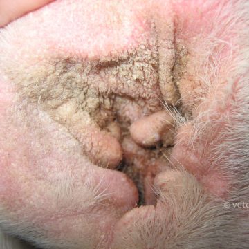 Krooniline allergiline otiit