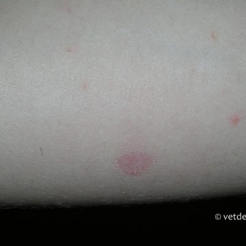 Dermatofütoos kassi omanikul-3